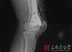 伴侣愈合高清在线观看,高清在线观看,情感疗愈之旅 第3张 伴侣愈合高清在线观看,高清在线观看,情感疗愈之旅 第3张